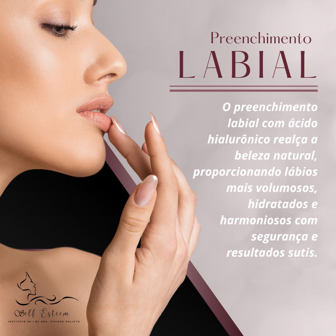 F - Preenchimento Labial